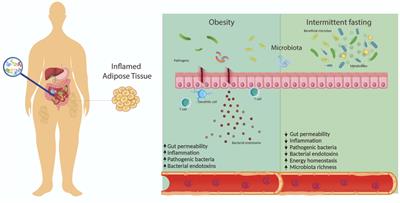 The effect of intermittent fasting on microbiota as a therapeutic approach in obesity